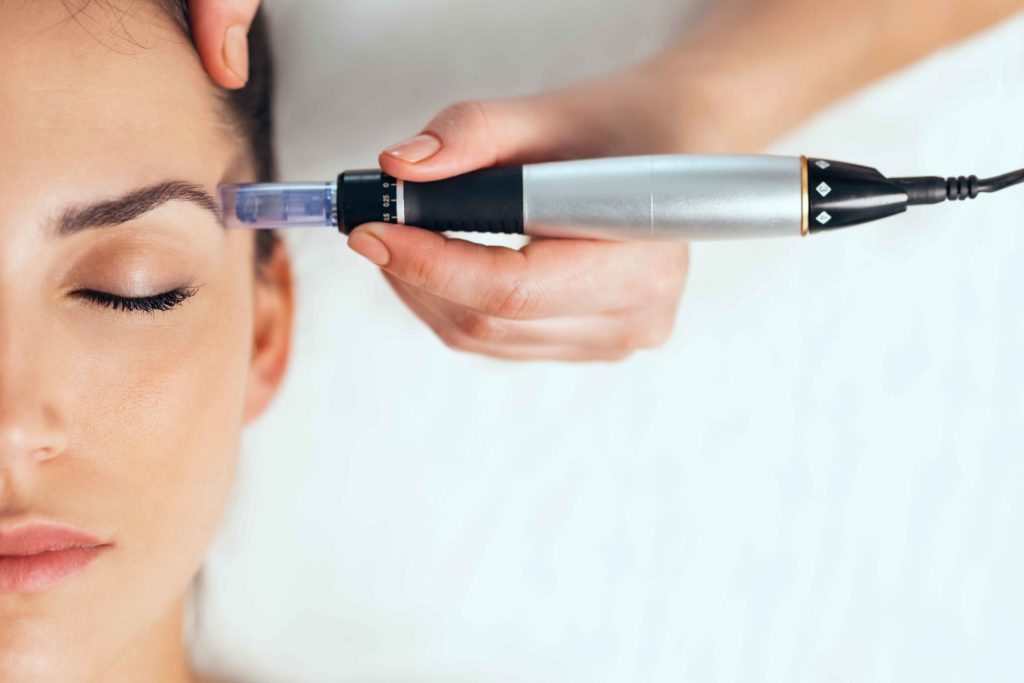 Microneedling treatment in Madison, Alabama | Nava Medical Aesthetics