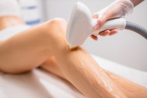 Laser Hair Removal A Cost-Effective and Time-Saving Solution Compared to Waxing Shaving or Plucking