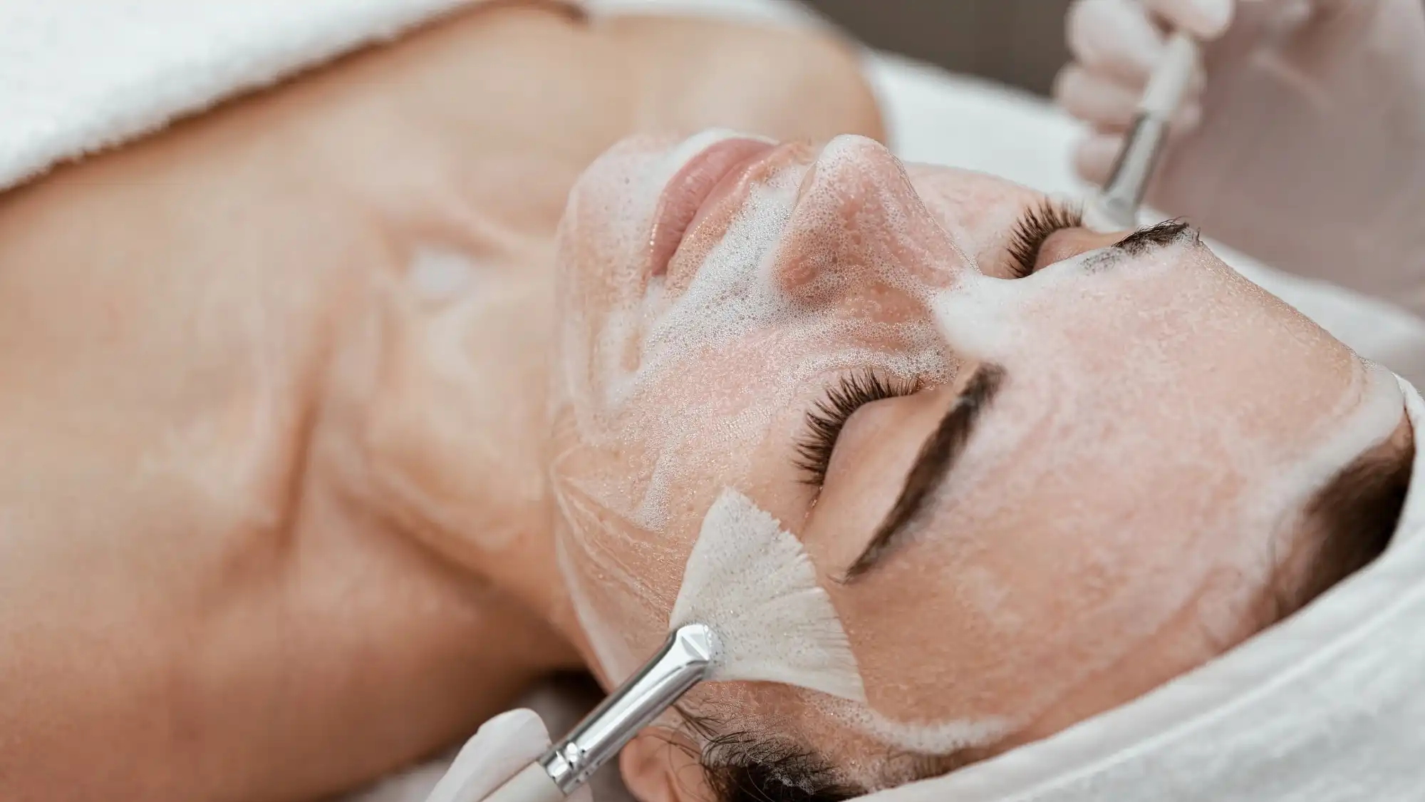 Facial Peel in Madison AL by Nava Medical Aesthetics