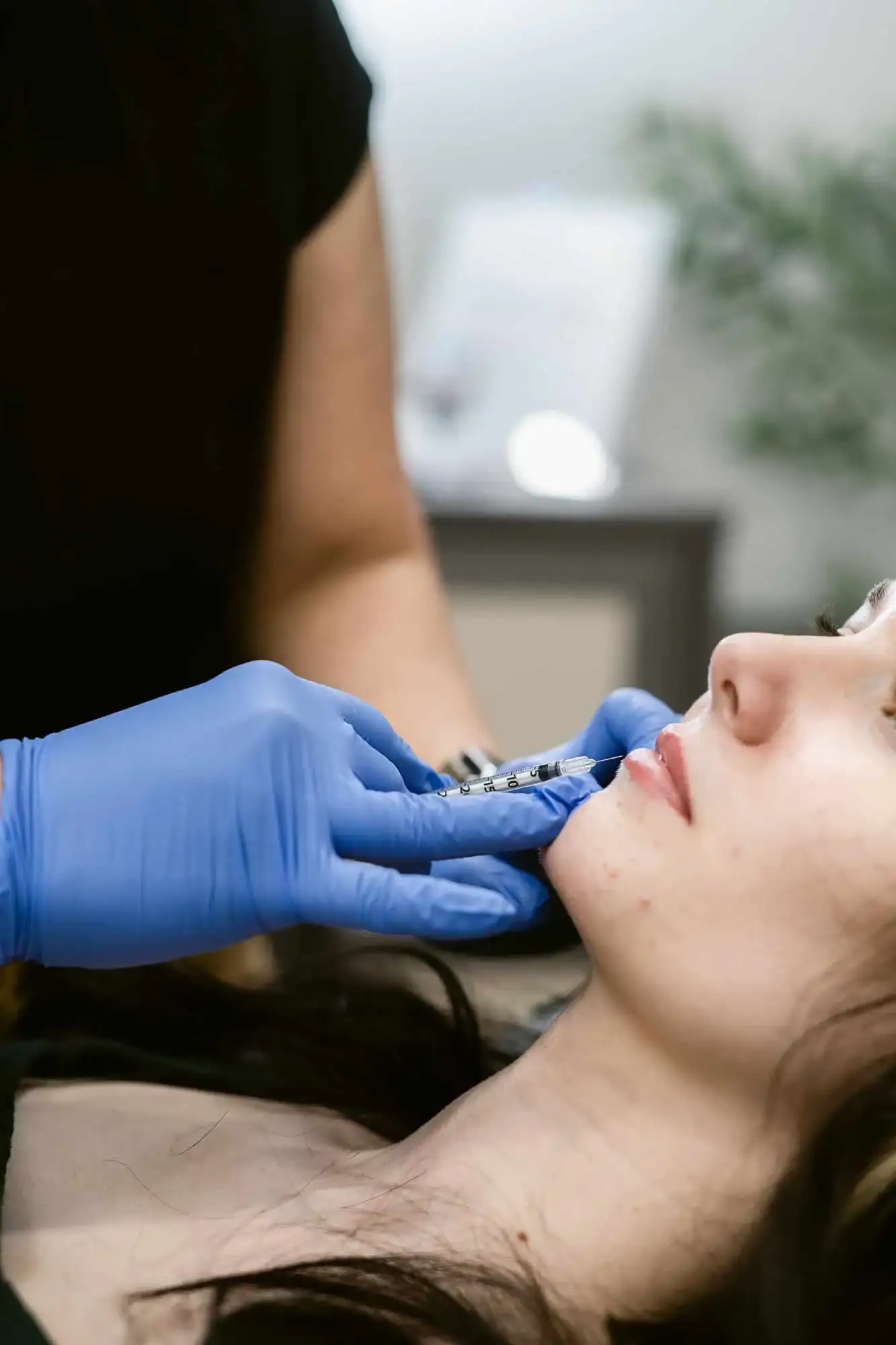 Fillers in Madison, AL by Nava Medical Aesthetics